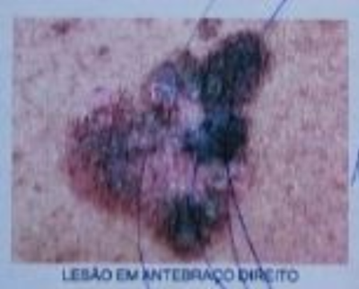 Imagem da questão